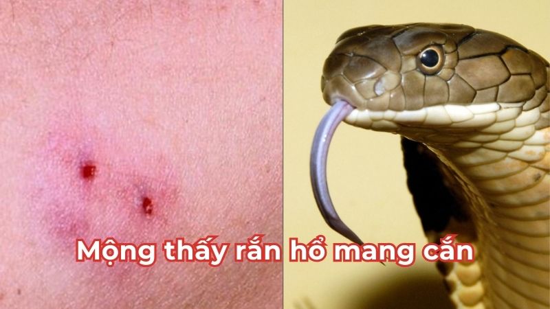 Mộng thấy rắn hổ mang cắn điềm gì Mộng thấy rắn hổ mang cắn điềm gì